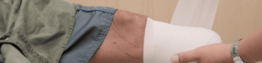 Bandage Wrapping Amputated Knee